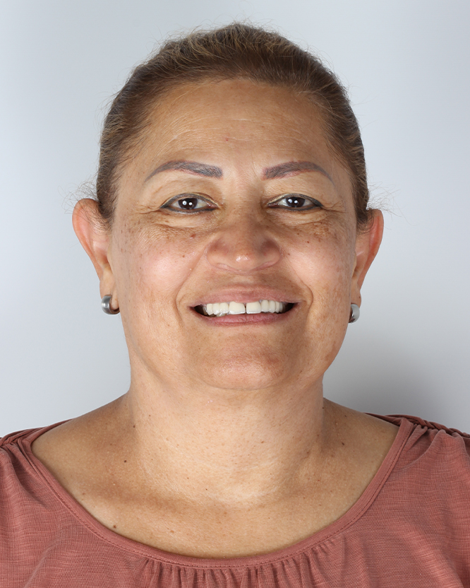 PATRICIA-LOPEZ-antes PATRICIA-LOPEZ-antes